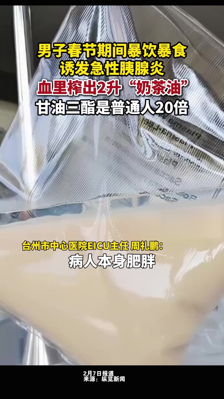 男子暴饮暴食血里榨出2升奶茶油,甘油三酯是普通人20倍!