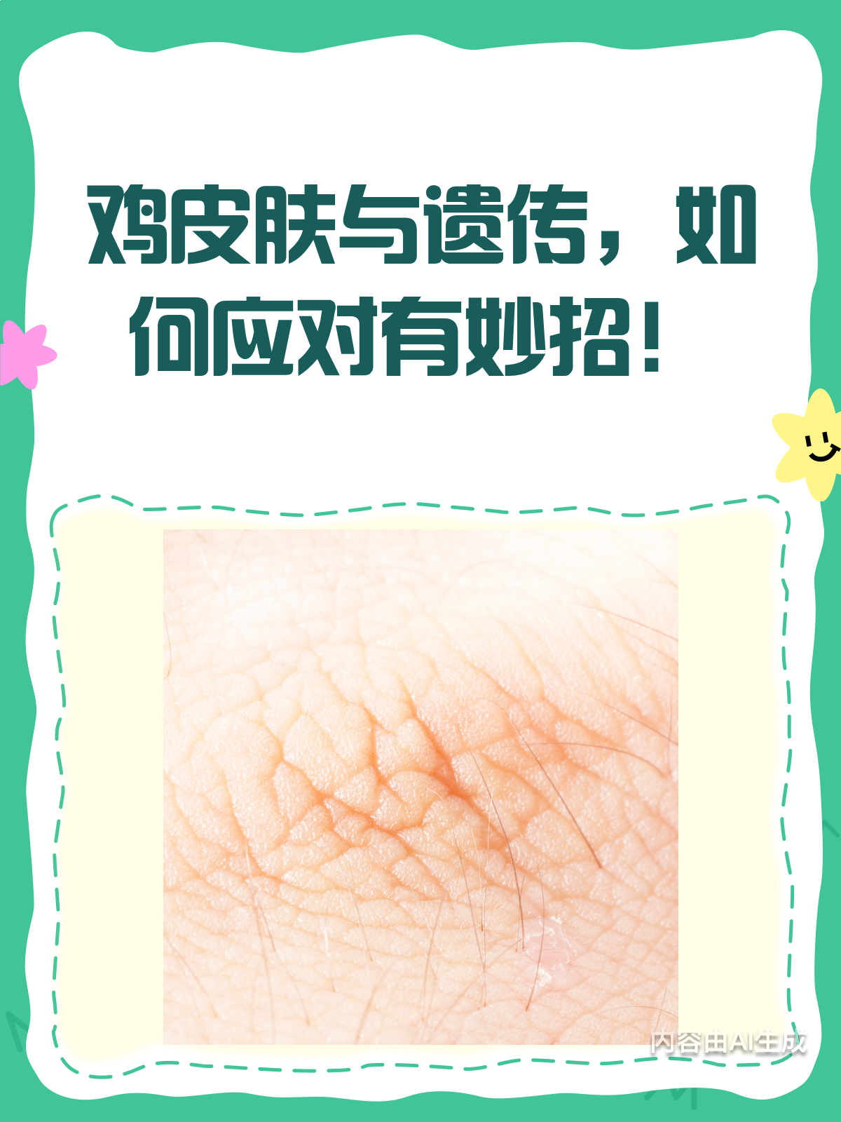 鸡皮肤烦恼多?遗传因素大揭秘!