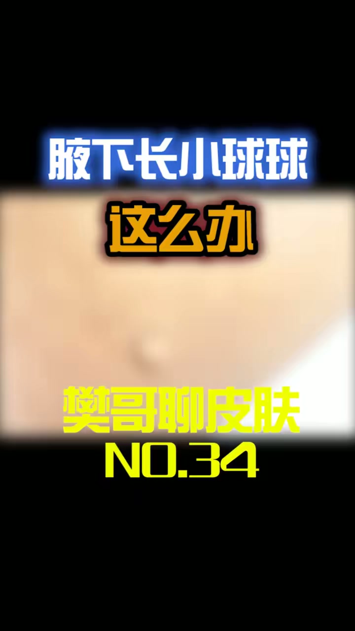 胳肢窝下长东西不要怕,一起了解下!