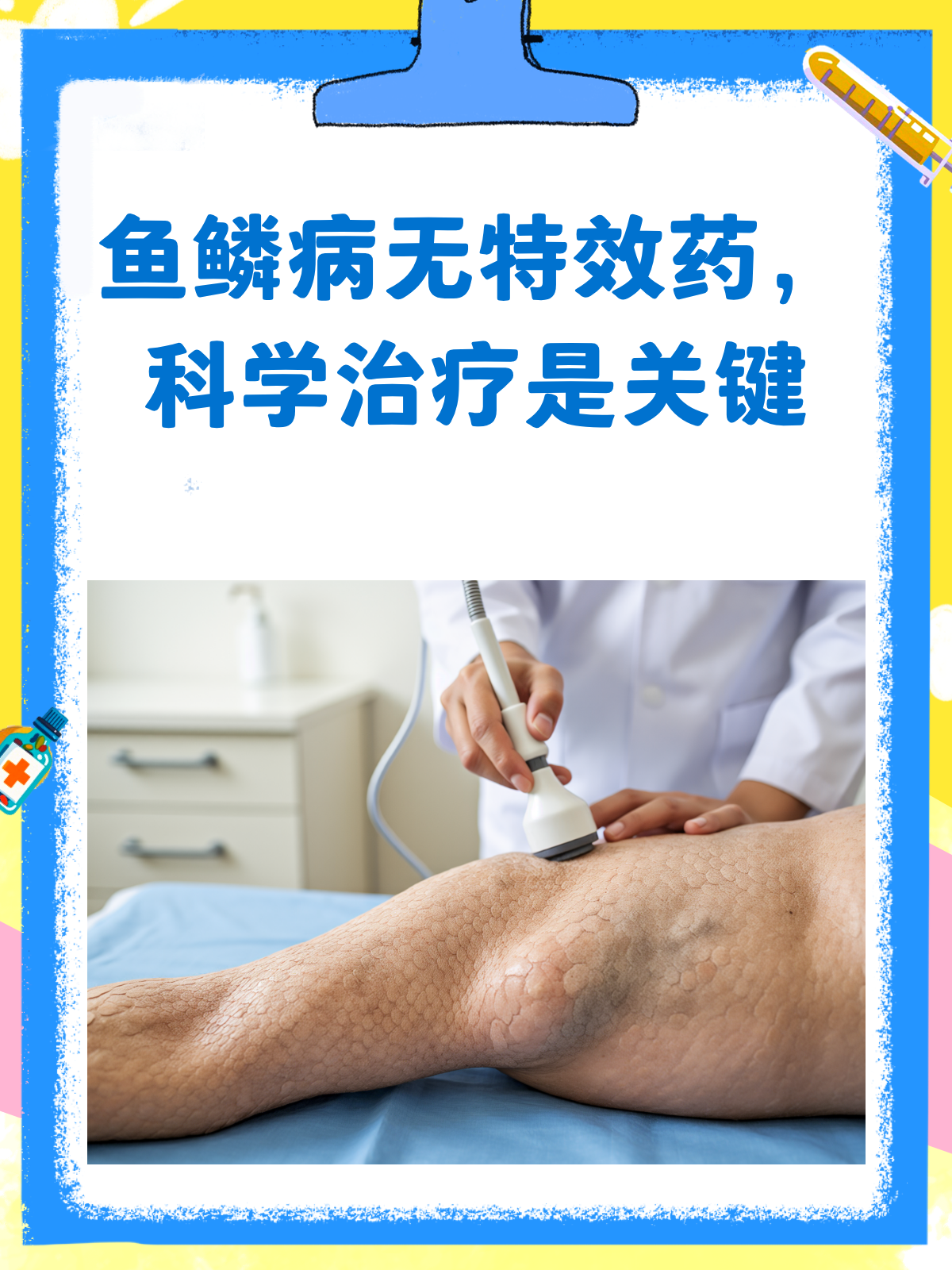 鱼鳞病治疗，别再迷信特效药了！