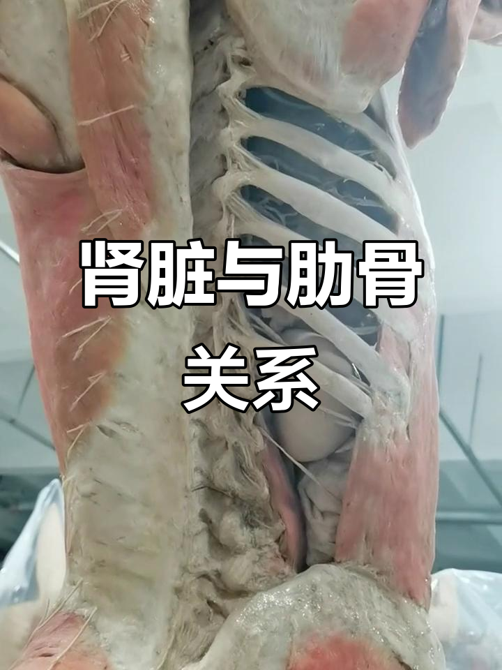 人体肾脏背面解剖,肋骨保护下的肾结构
