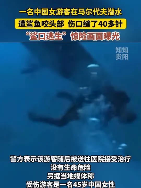 一名中国女游客在马尔代夫潜水遭鲨鱼咬头部,“鲨口逃生”伤口缝了40多针