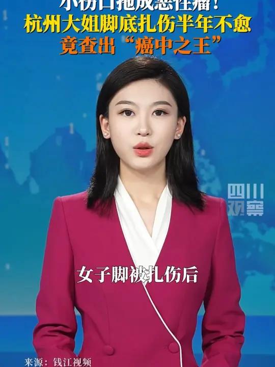 8月1日据钱江视频，杭州一女子脚被扎伤后长出癌中之王伤口反复破溃出血还长出小肉球，大姐拖了