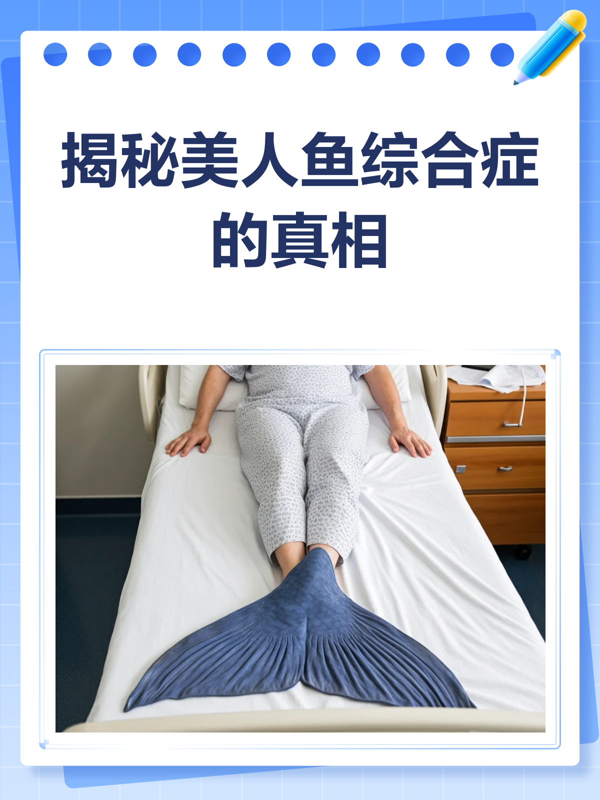 揭秘美人鱼综合症♀,你真的了解吗?