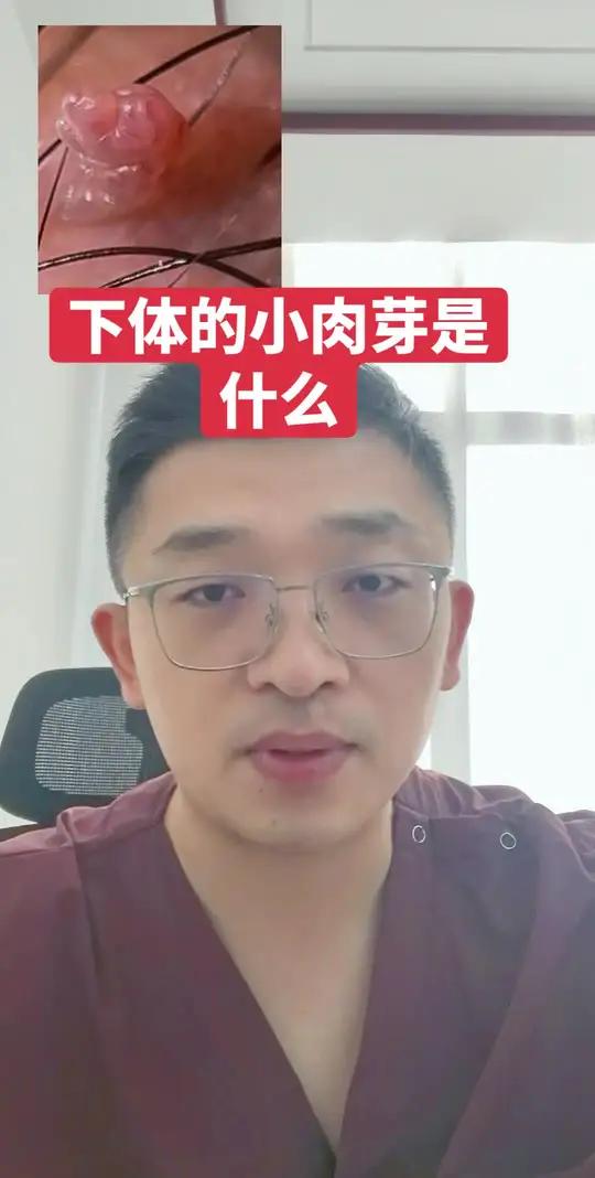 下体的小肉芽是什么 