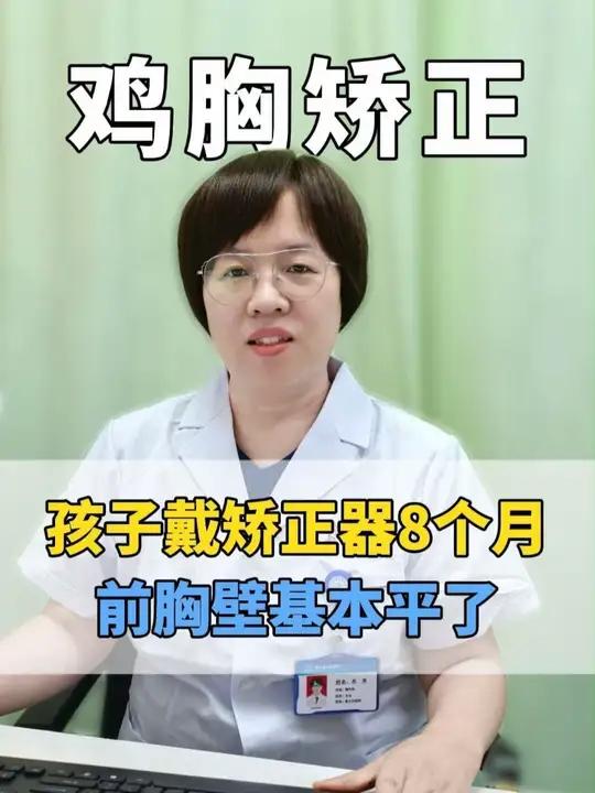 女孩鸡胸戴矫正器8个月,坚持每天科学佩戴,现在前胸壁基本已经平了
