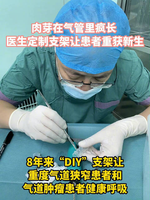 万象「武汉一医生8年来因人而异“DIY”气管支架「心」」增生的肉芽组织几乎将气道塞得难以呼