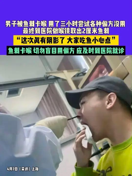 4月7日(采访)上海:男子被鱼刺卡喉 用了三小时尝试各种偏方没用,最终到医院做喉镜取出2厘