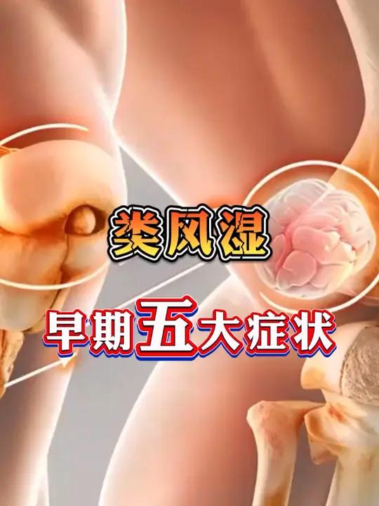 类风湿早期五大症状,注意!