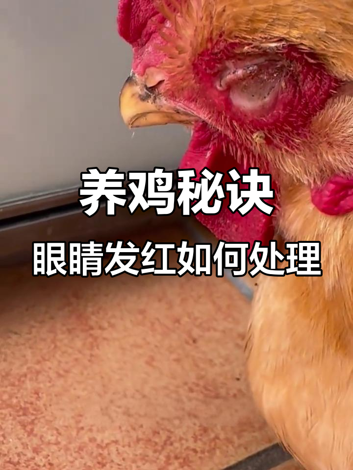 鸡眼红肿怎么办?教你快速应对方法