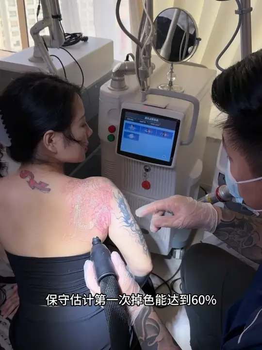 命运在新陈代谢,期待一年后如愿穿无袖婚纱