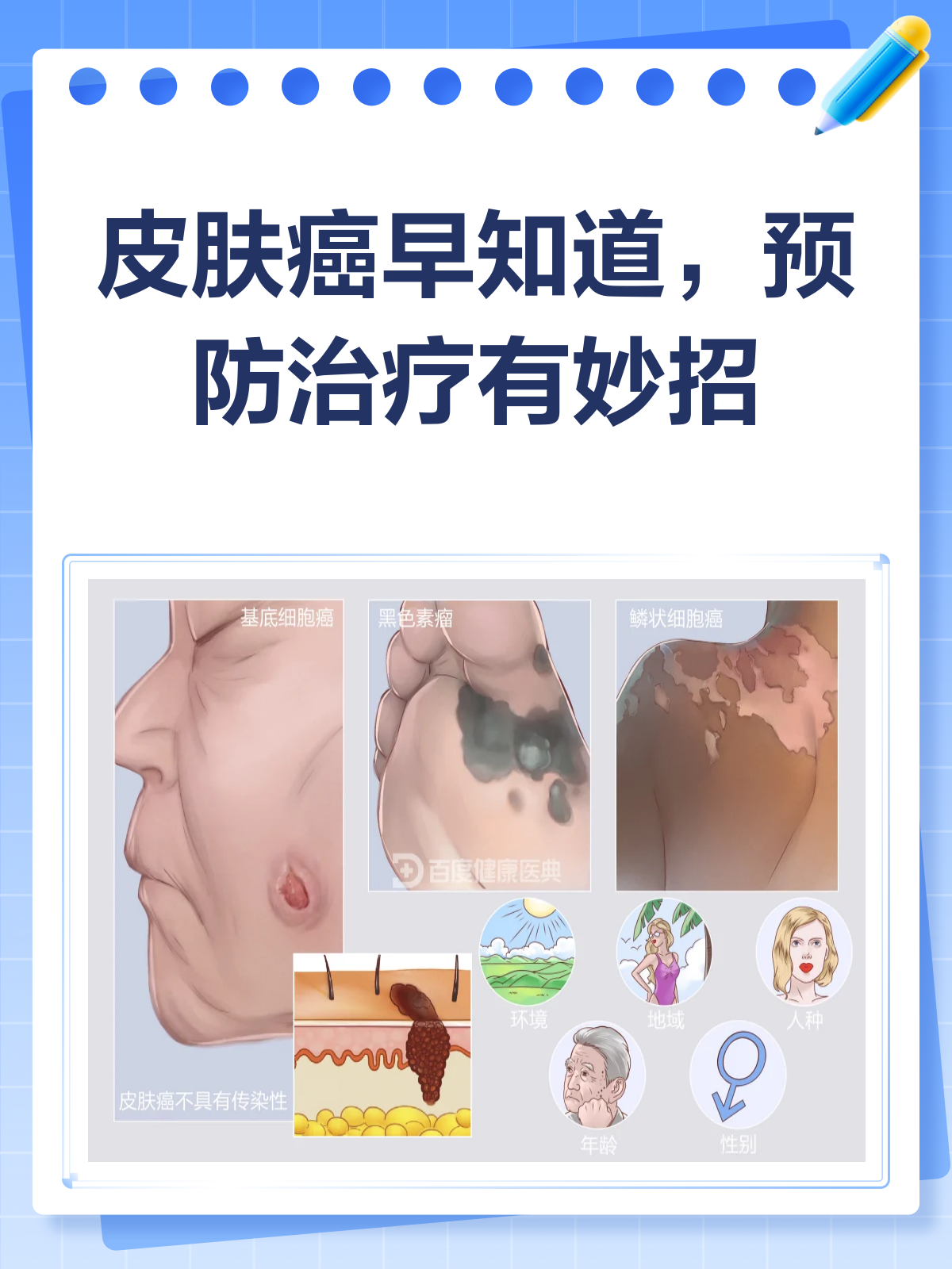 皮肤癌来袭?早期信号与应对攻略!