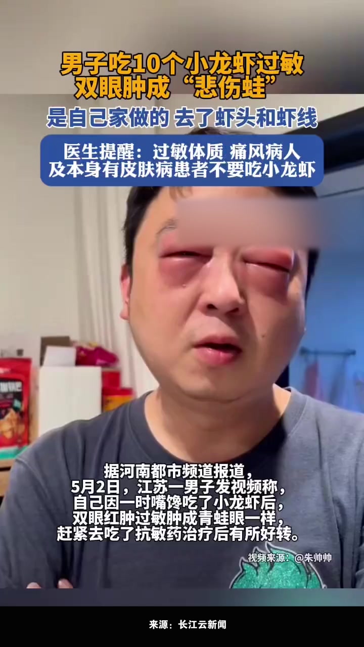 男子吃小龙虾过敏双眼肿成“悲伤蛙”
