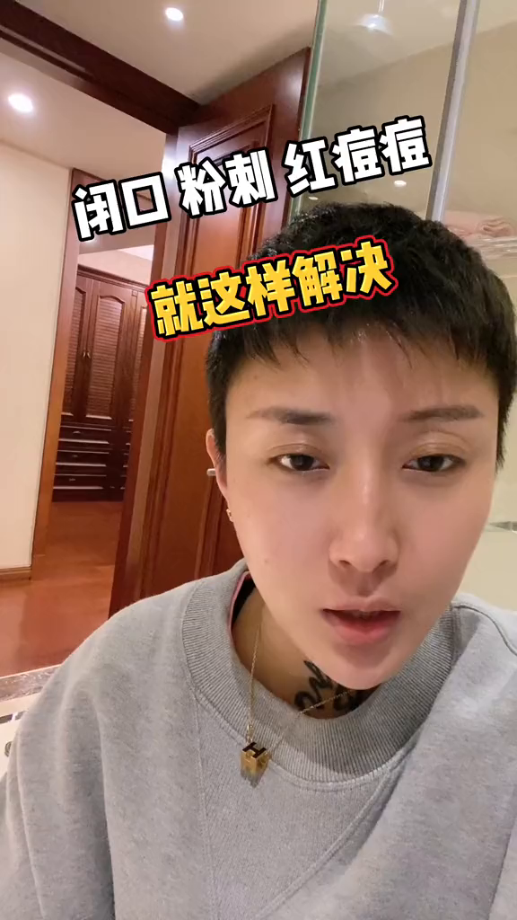 痘痘的清道夫,Suan护肤杏仁酸水杨酸