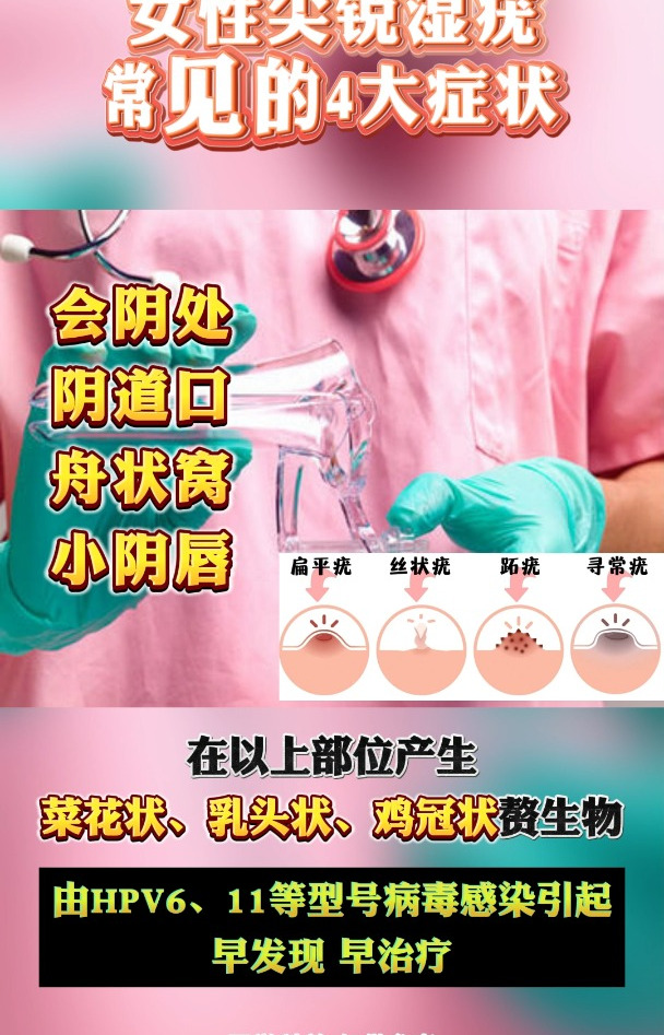 女性尖锐湿疣常见的4大症状