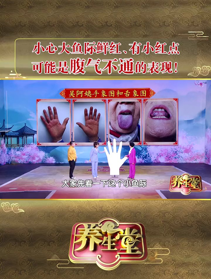 小心大鱼际鲜红,有小红点,可能是腹气不通的表现!