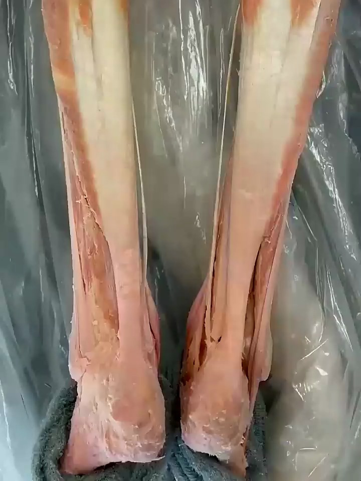 人体最强大的肌腱,可以承受把倍于体重的拉伸负荷,千万保护好它