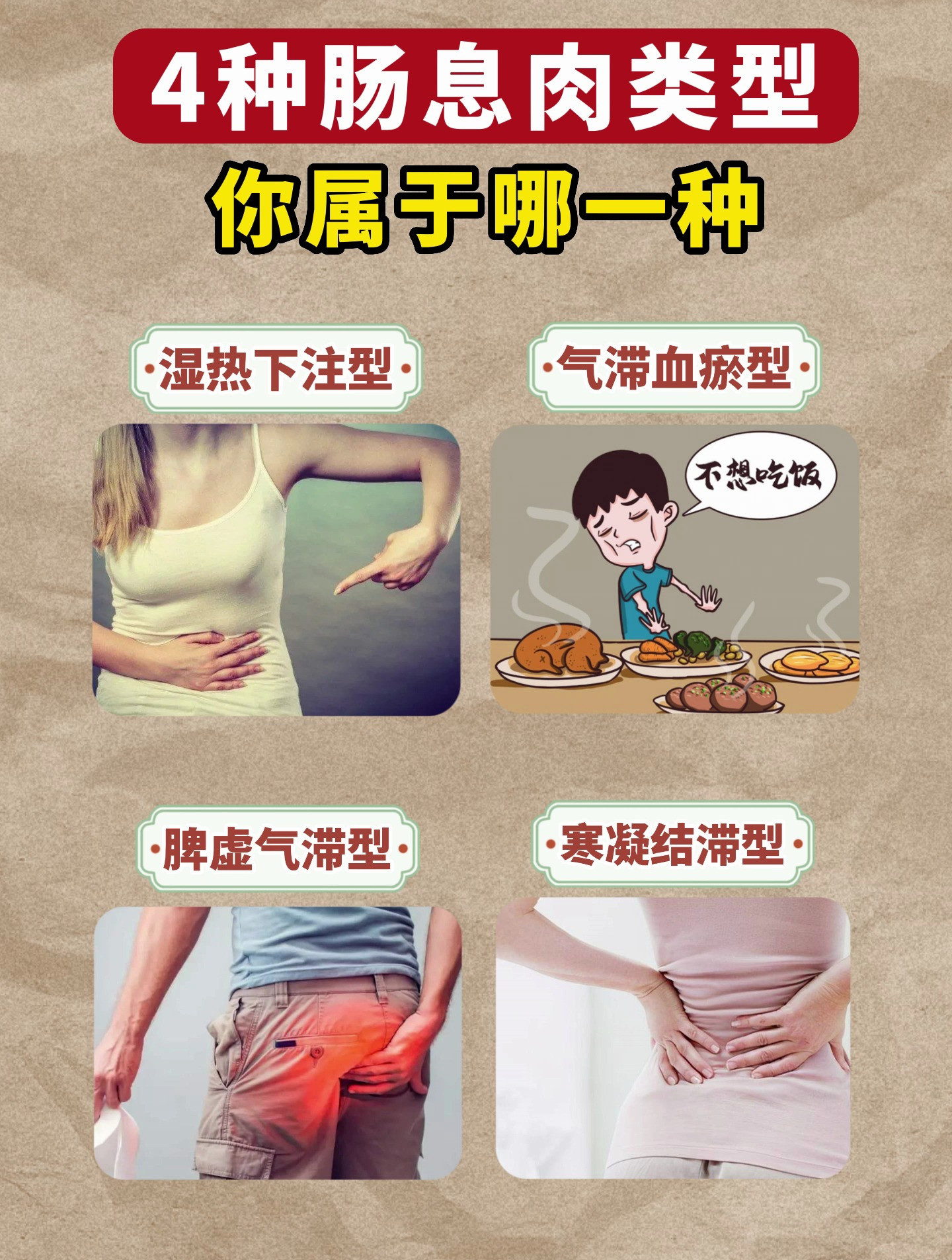 4种肠息肉类型,你是哪一种