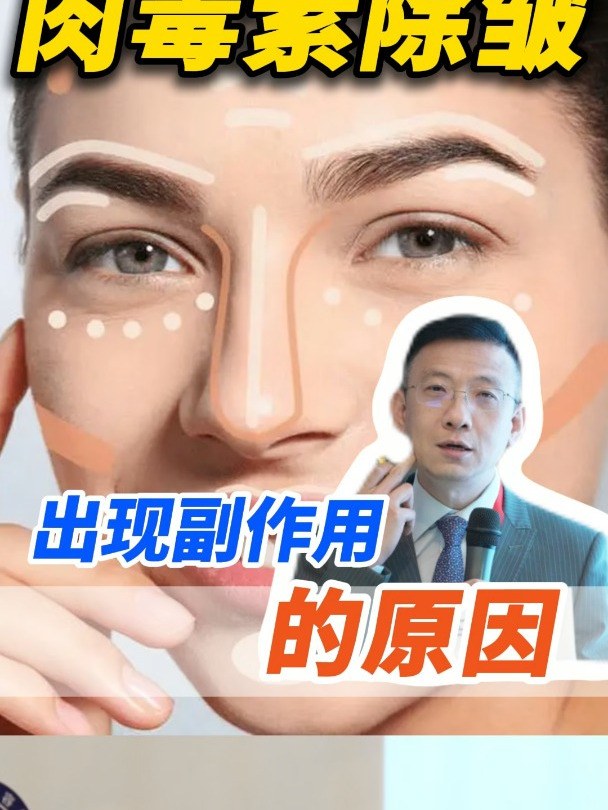 肉毒素除皱出现副作用的原因