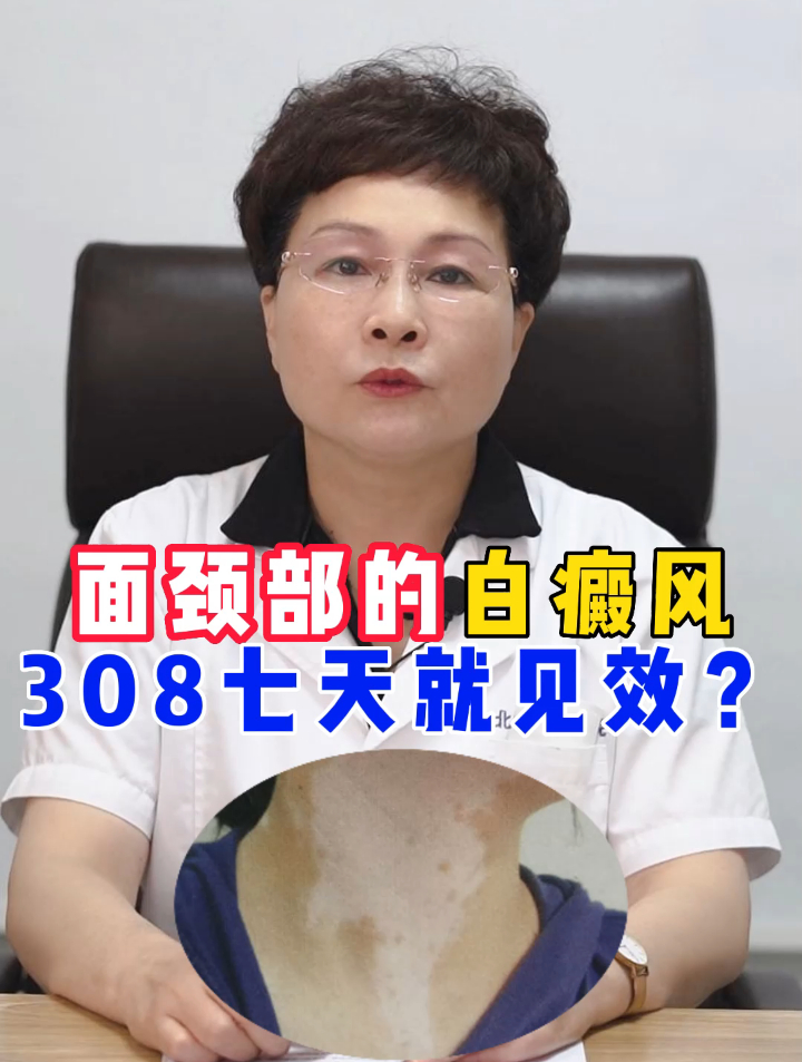 面部白斑,照308七天就能看到效果,真有这么神奇?