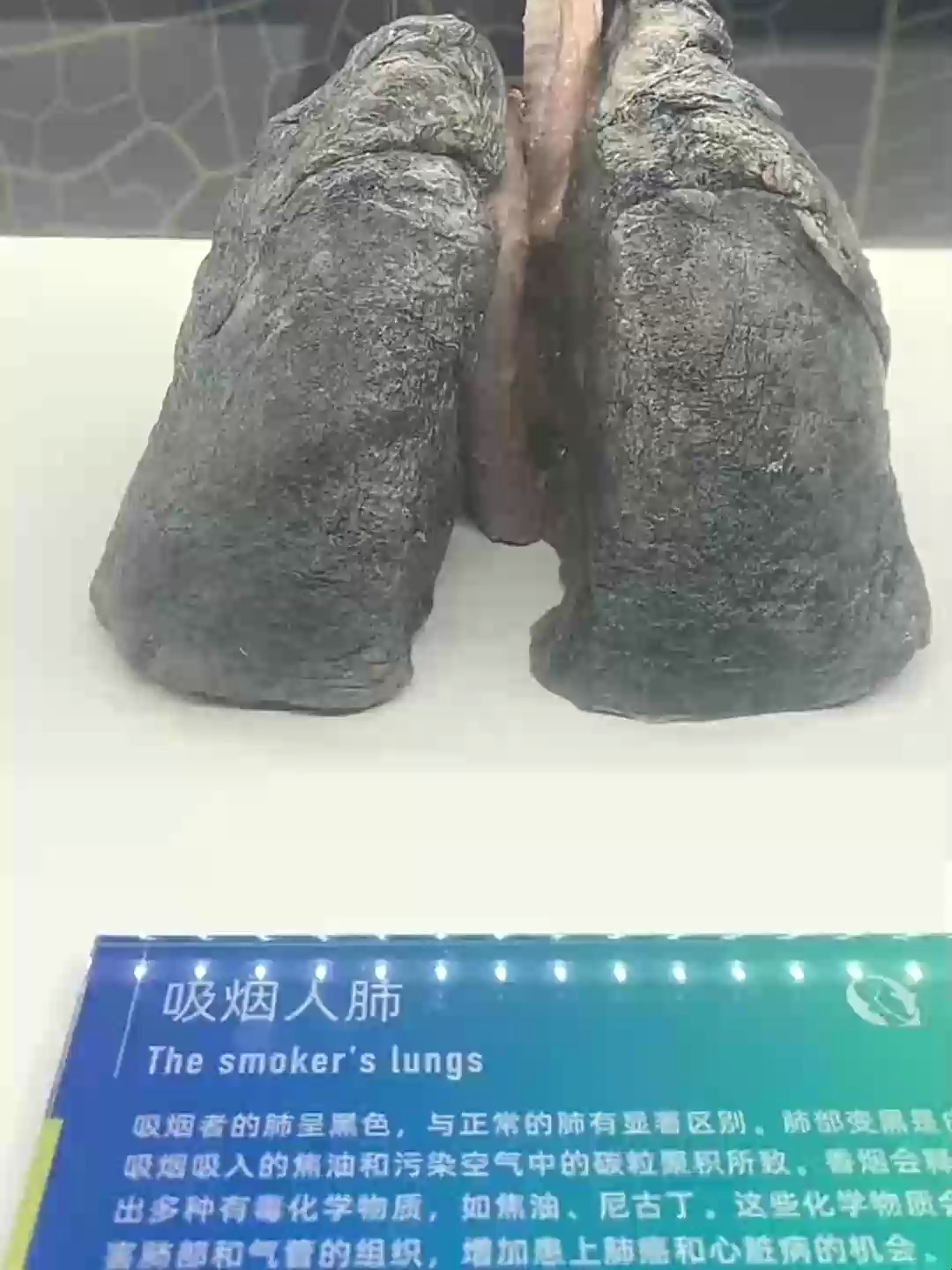 吸烟者和正常人的肺
