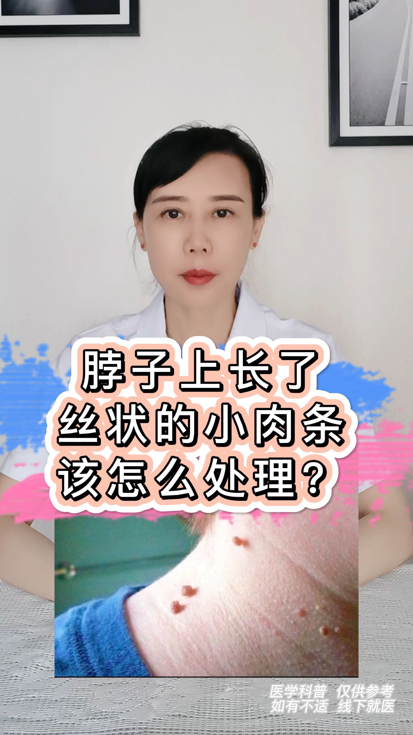 脖子上长了丝状的小肉条,该怎么处理?