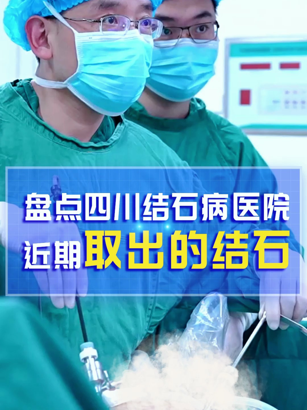 四川结石病医院:快来看稀奇!结石到底长什么样子?