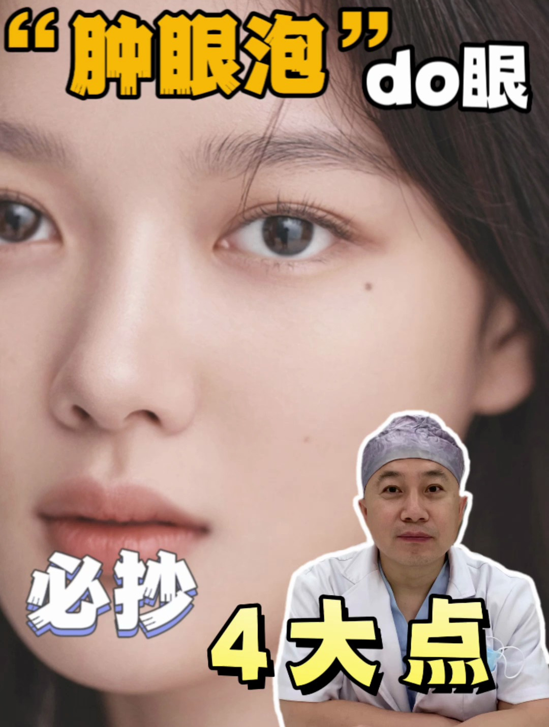 肿眼泡do眼,必抄4大点!