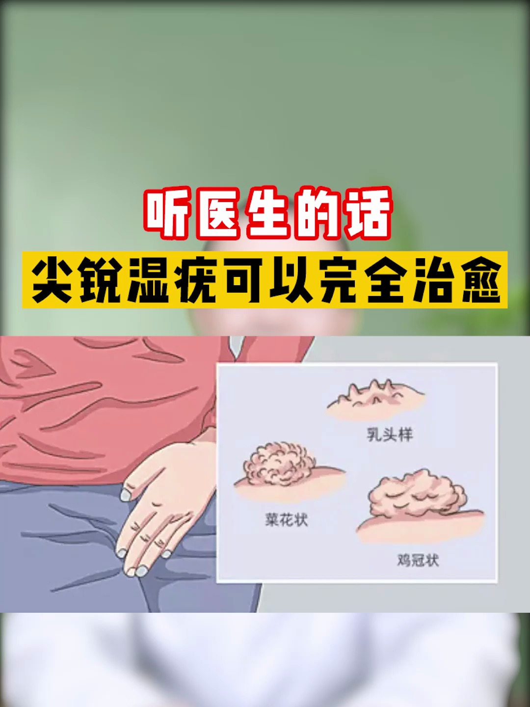 13听医生的话 尖锐湿疣可以完全治愈