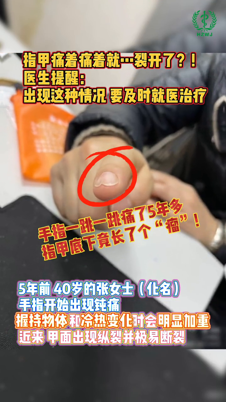 指甲痛着痛着就……裂开了?!
