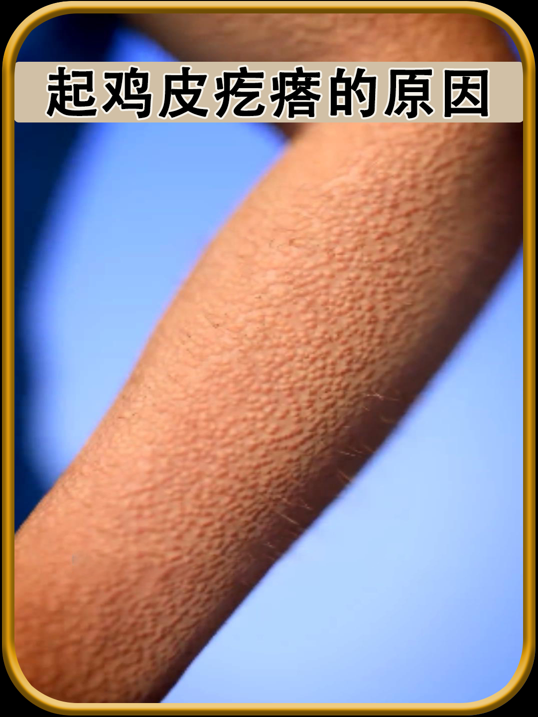 起鸡皮疙瘩的原因