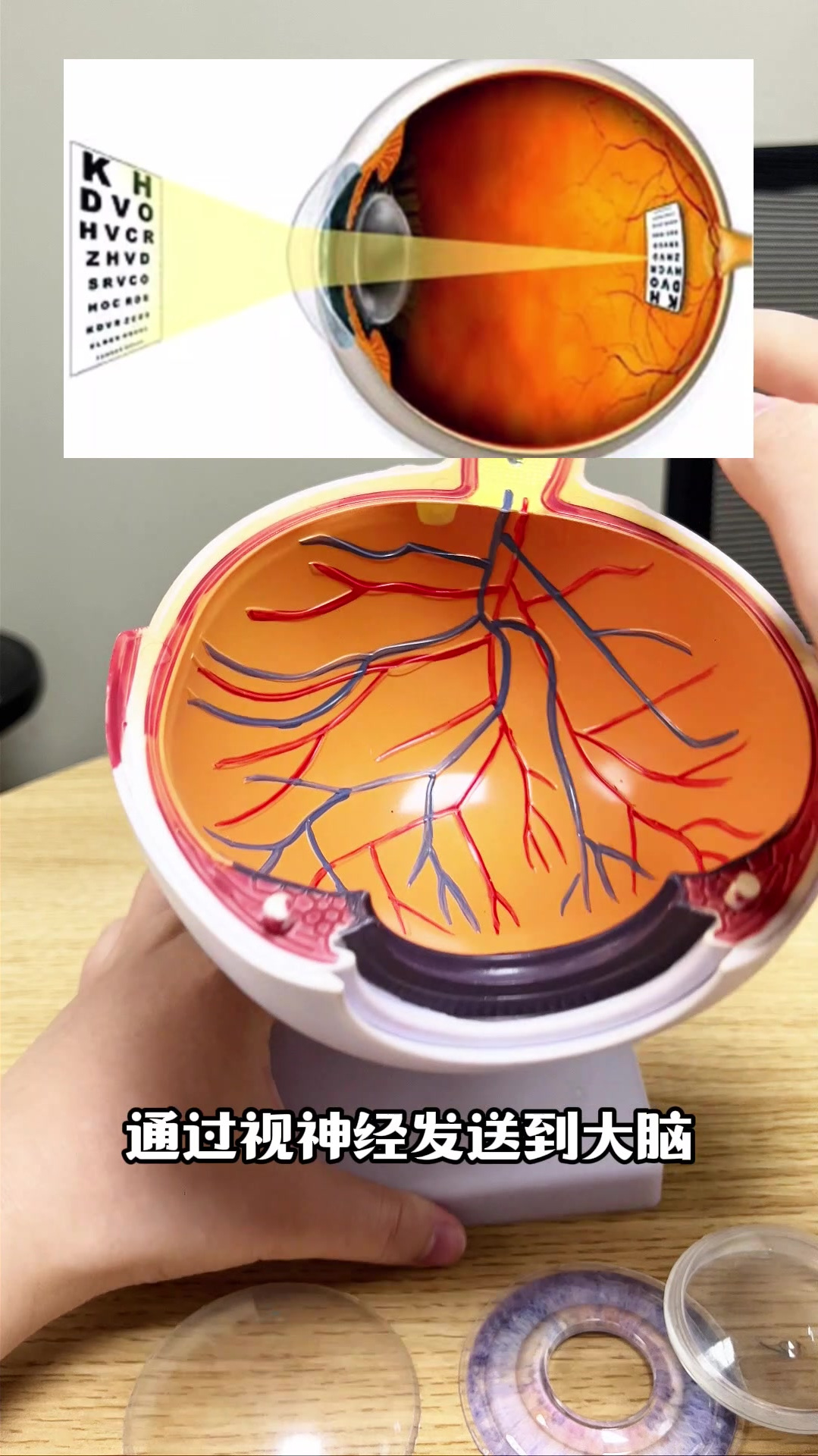眼睛的结构,你都知道吗