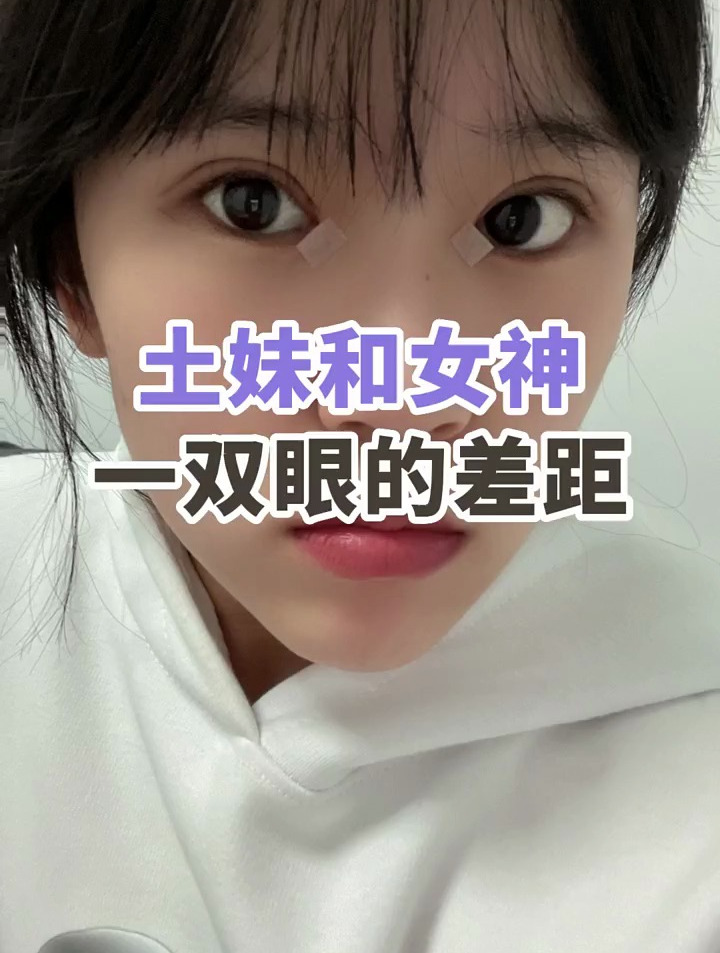 土妹离女神就只有一双眼睛的差距,做双眼皮到底能有多大改变?