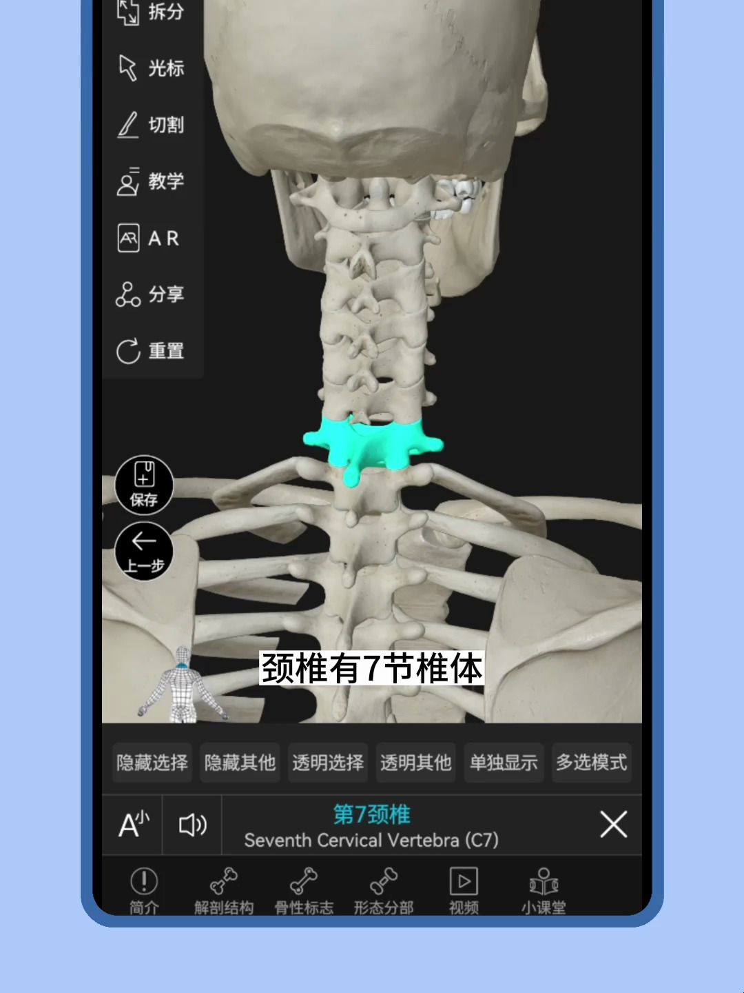 维萨里3D解剖,19.9查询人体四个生理曲度!