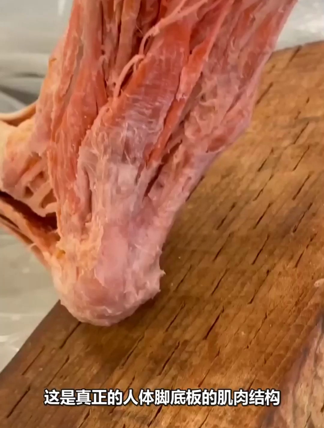 这是真正的人体脚底板的肌肉结构