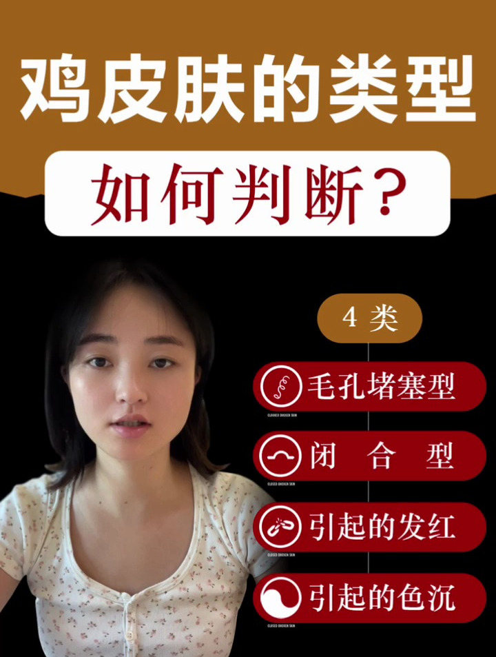 鸡皮肤类型的判断