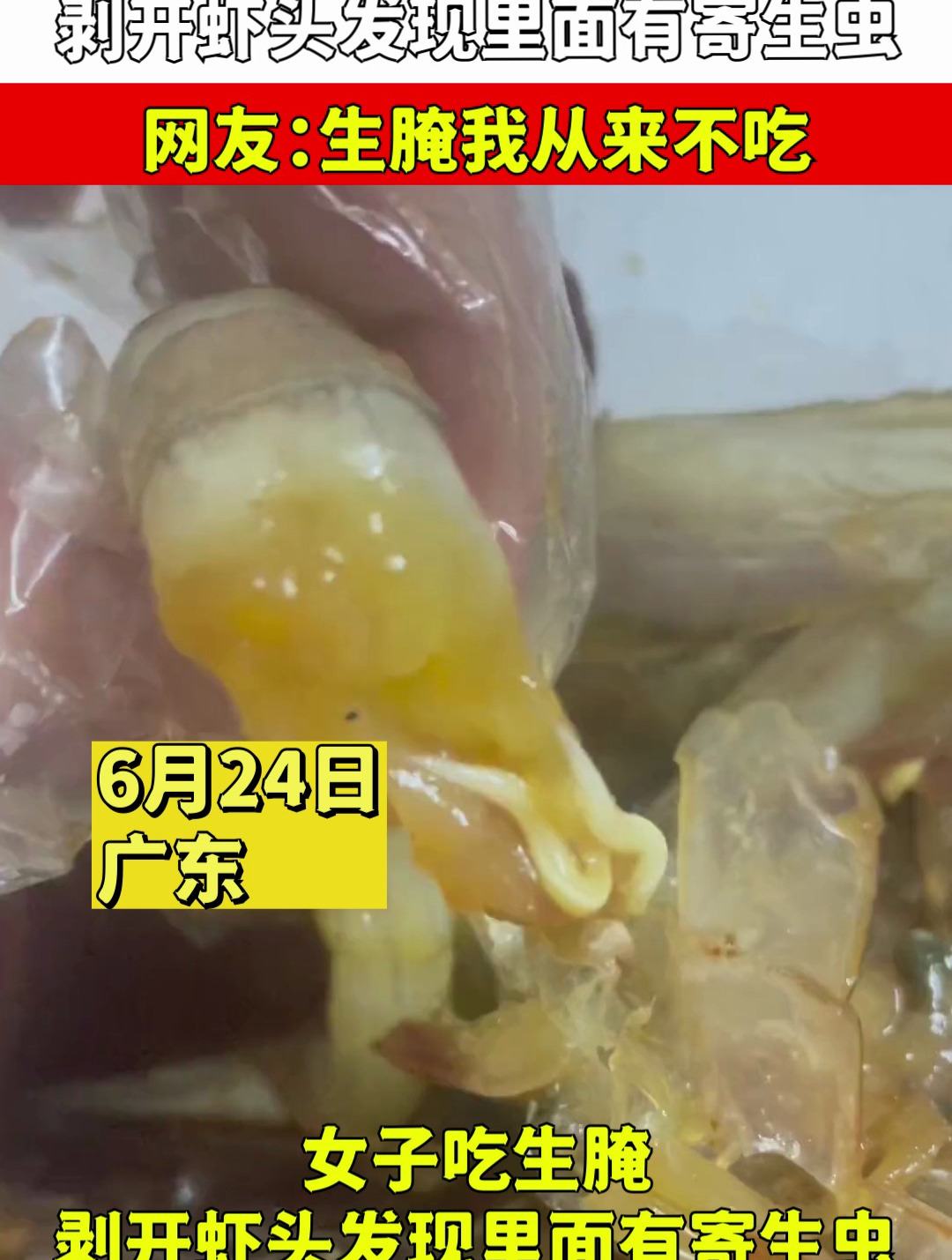女子吃生腌,剥开虾头发现里面有寄生虫,网友:生腌我从来不吃