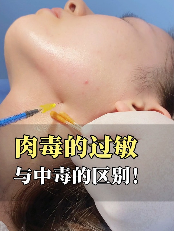 肉毒的过敏与中毒的区别!