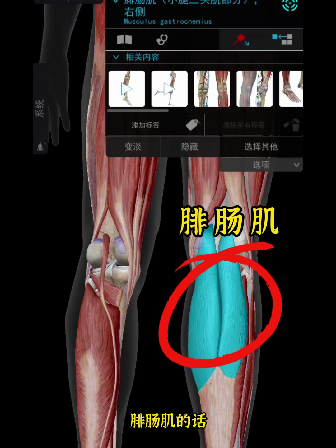 小腿内侧疼痛不舒服,是怎么回事呢?