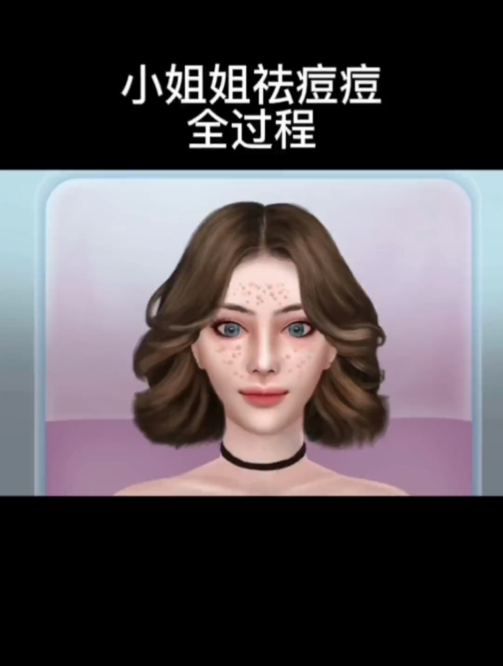 美妆解压,小姐姐祛痘全过程,摇身一变大美女!
