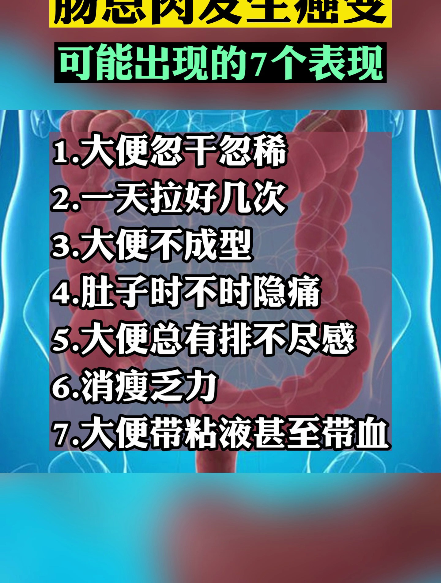 肠息肉癌变 可能出现的7个表现