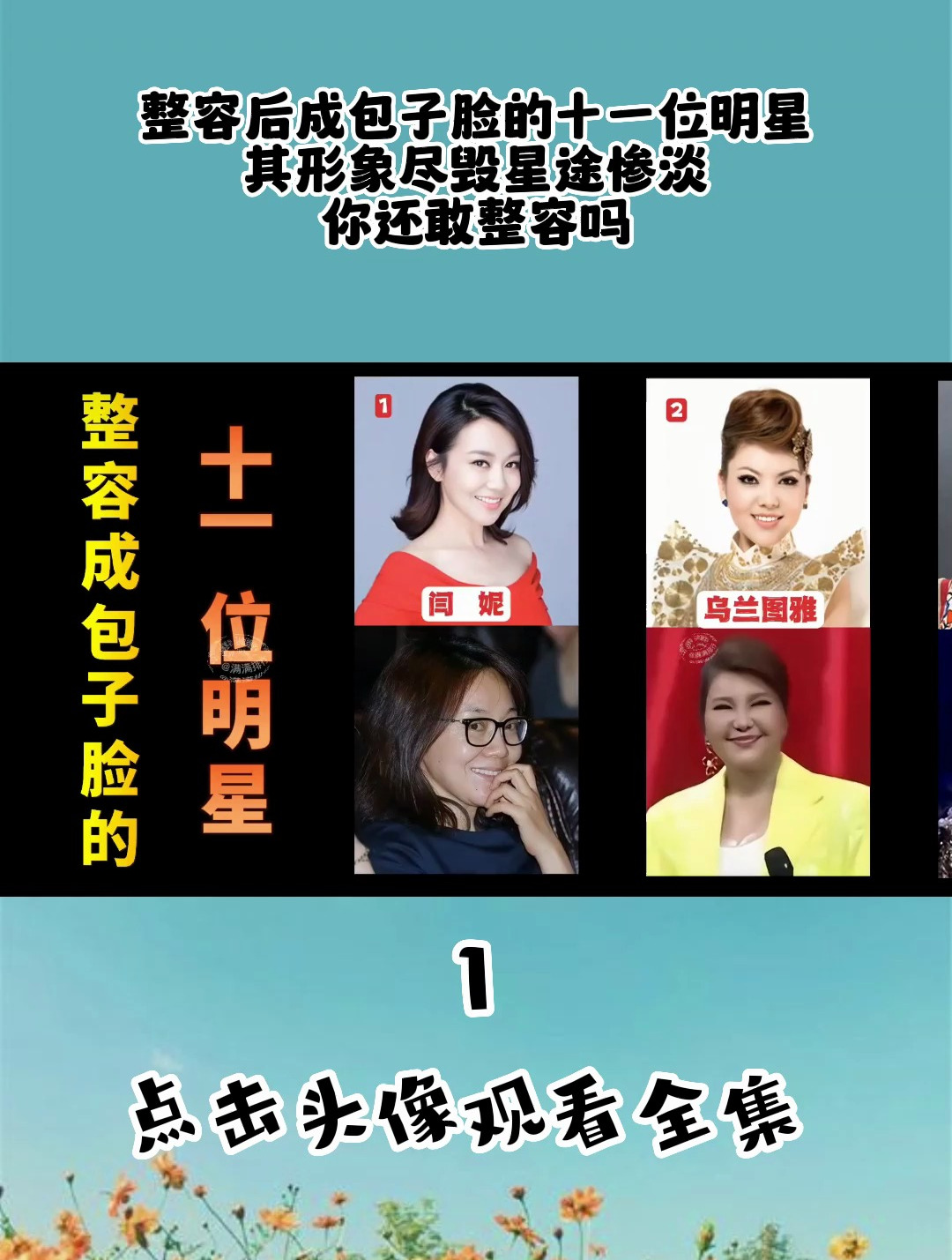 整容后成包子脸的十一位明星,其形象尽毁星途惨淡,你还敢整容吗