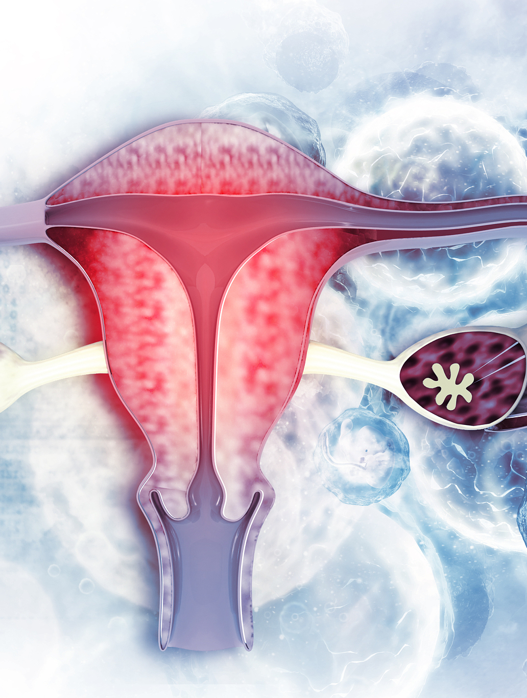 子宫内膜异位症和巧克力囊肿是一回事吗?