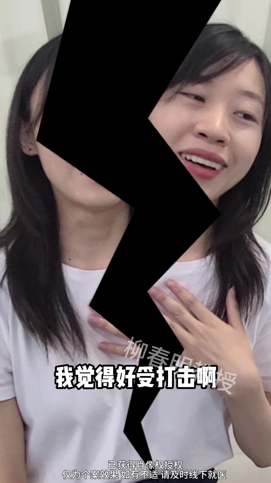从“鲶鱼嘴”到女神 只需要一个月