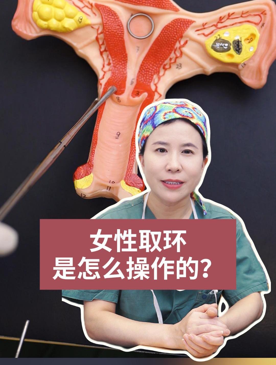 女性取环是怎么操作的?
