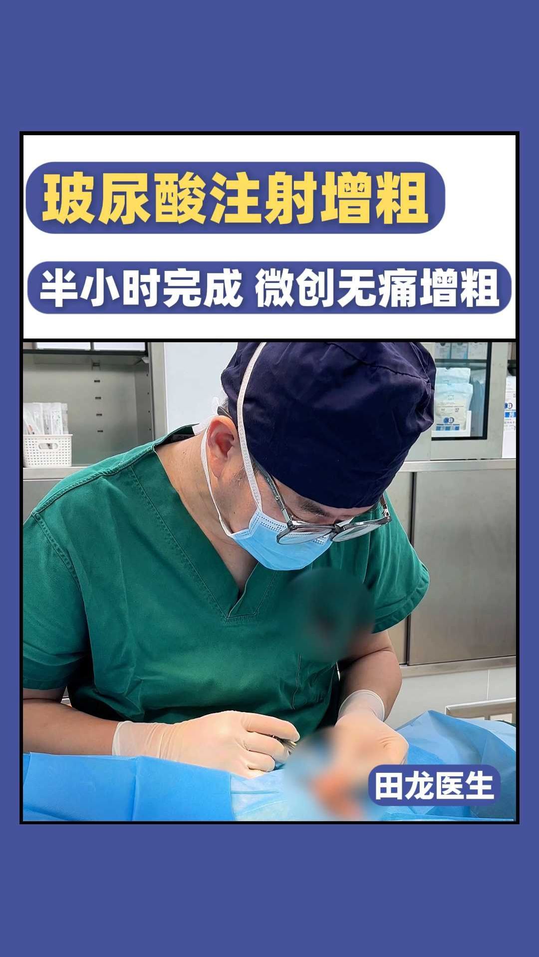 玻尿酸注射增粗，半小时完成 微创无痛增粗