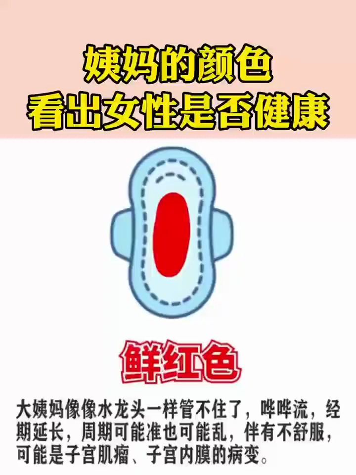 你的姨妈是什么颜色呢?