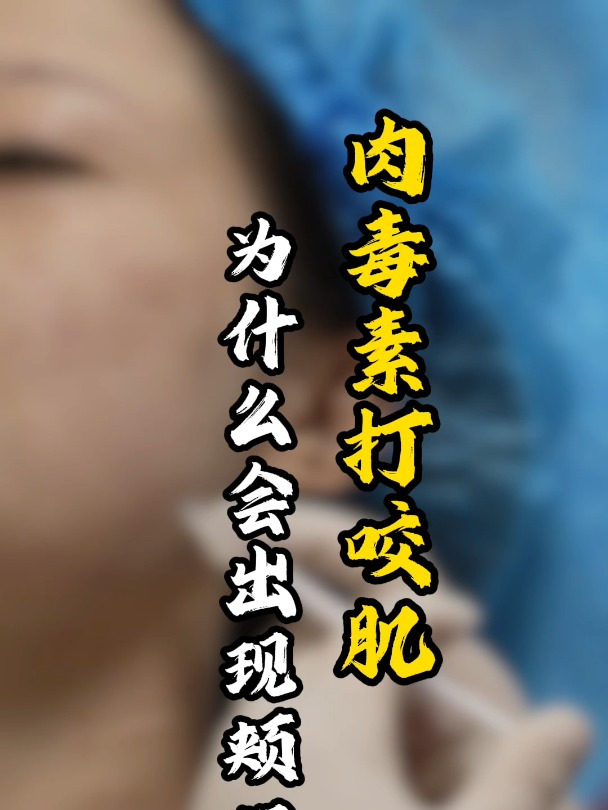 肉毒素打咬肌为什么出现脸颊凹陷?
