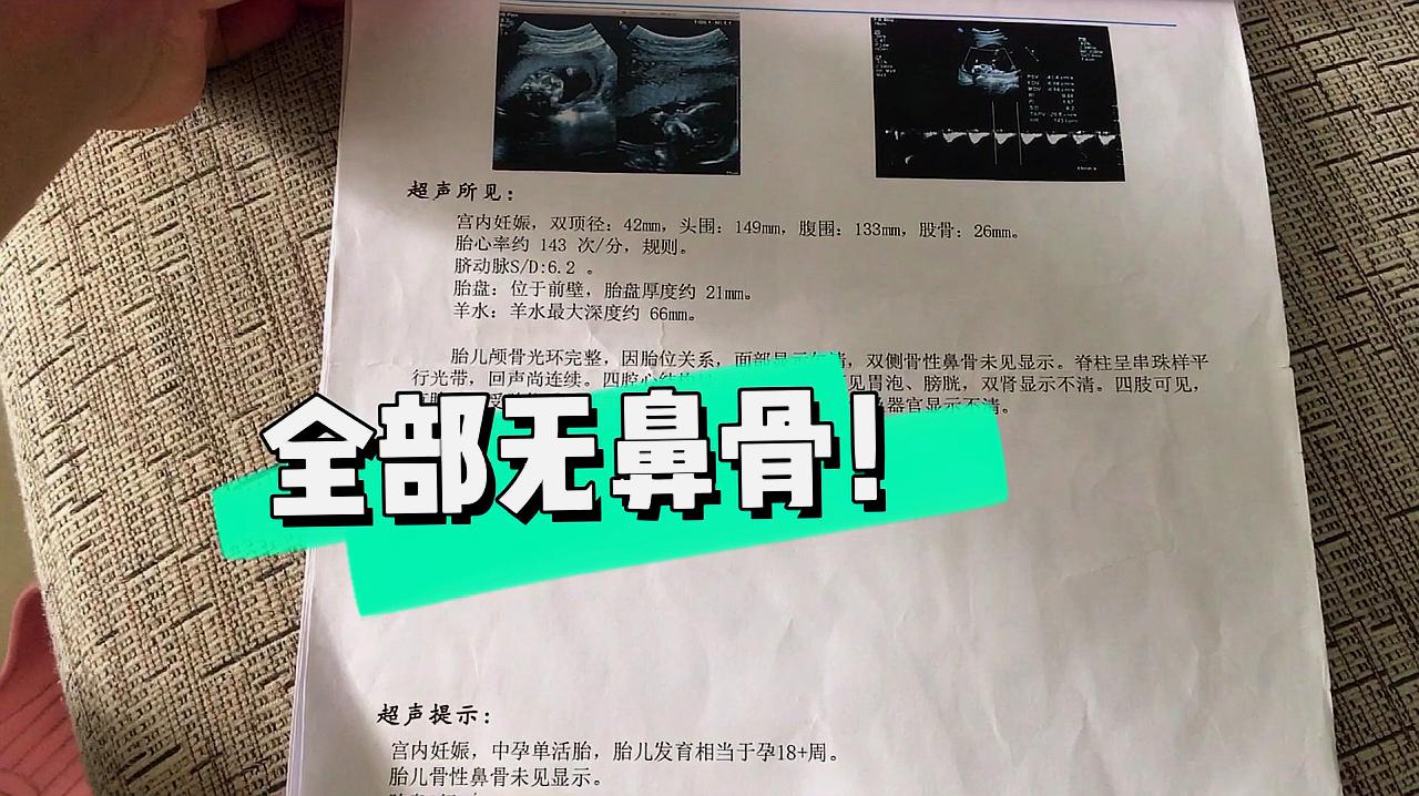 [图]危险期后一路“红灯”无鼻骨就是唐氏宝宝?孕妈的路该何去何从?