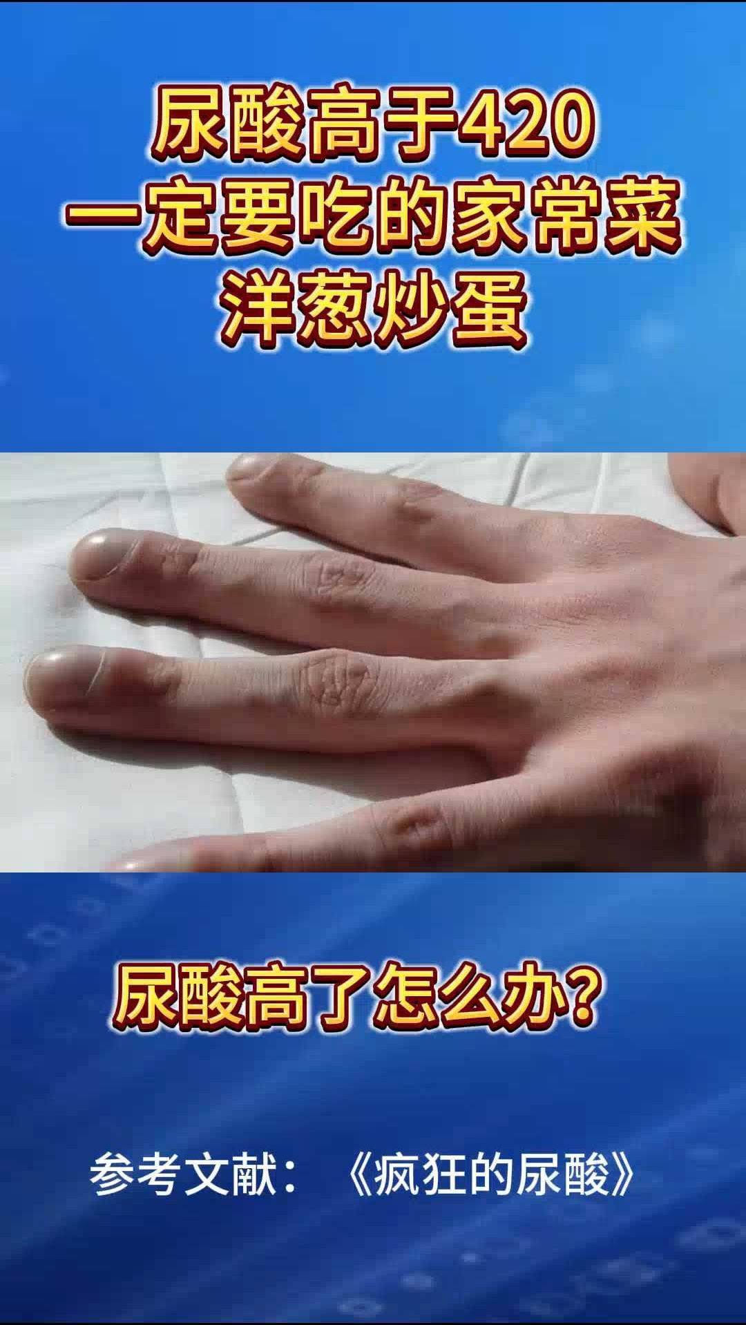 高尿酸痛风了,一定要吃洋葱炒蛋